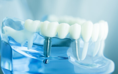 Zahnarztpraxis Dr. med. Peter Lautenschläger