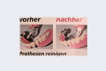 Prothesenreinigung Prothesenreinigung